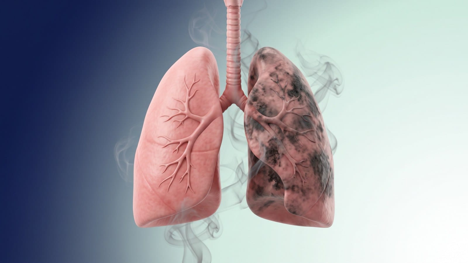 Illustration of lungs with one side stained by black soot from smoking